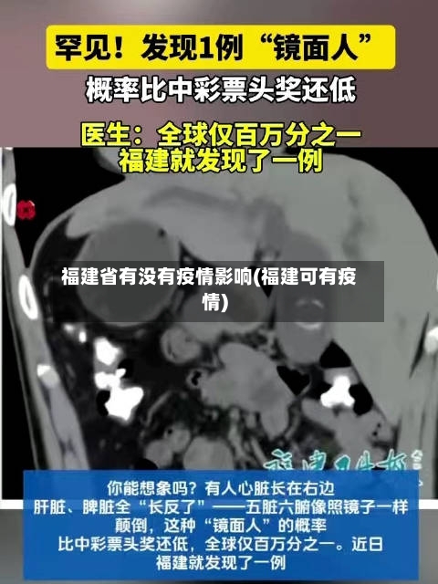 福建省有没有疫情影响(福建可有疫情)-第3张图片