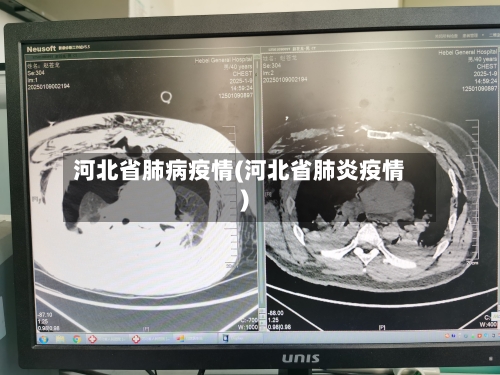 河北省肺病疫情(河北省肺炎疫情)-第1张图片