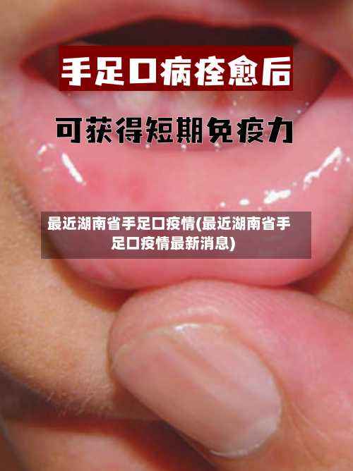 最近湖南省手足口疫情(最近湖南省手足口疫情最新消息)-第1张图片