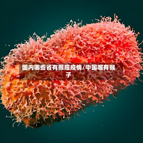 国内哪些省有猴痘疫情/中国哪有猴子-第1张图片