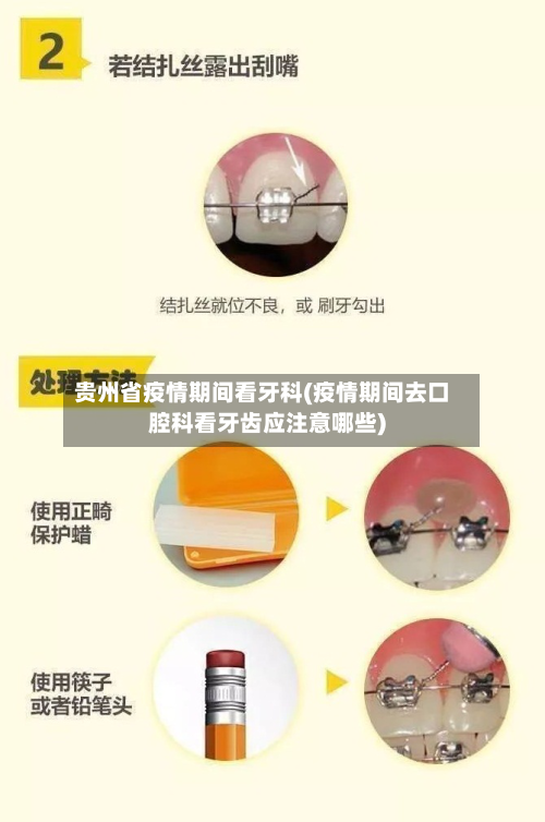 贵州省疫情期间看牙科(疫情期间去口腔科看牙齿应注意哪些)-第2张图片