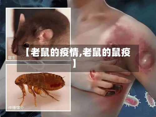 【老鼠的疫情,老鼠的鼠疫】-第2张图片