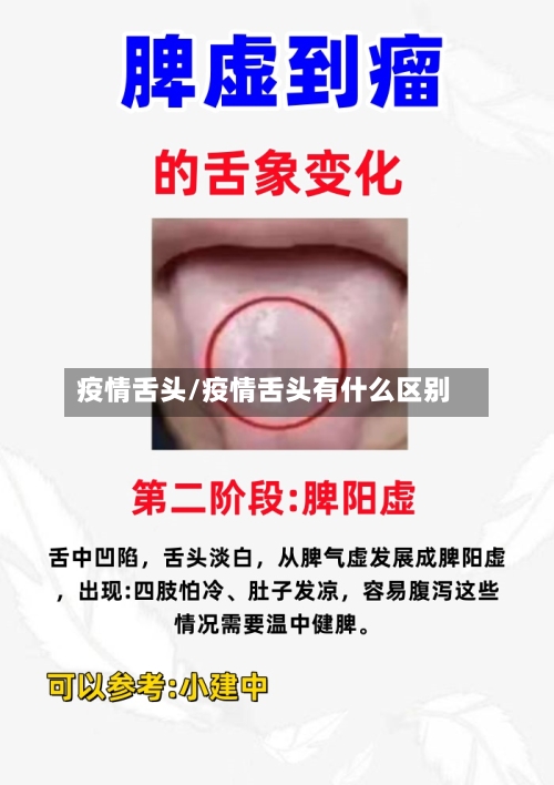 疫情舌头/疫情舌头有什么区别-第1张图片