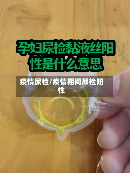 疫情尿检/疫情期间尿检阳性-第3张图片