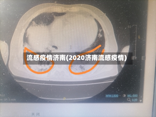 流感疫情济南(2020济南流感疫情)-第2张图片